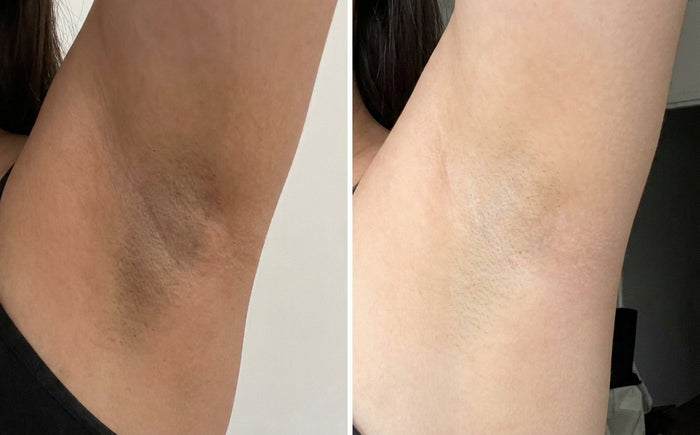 Soins Sweet Nabbody, avant et après, photo d'une cliente