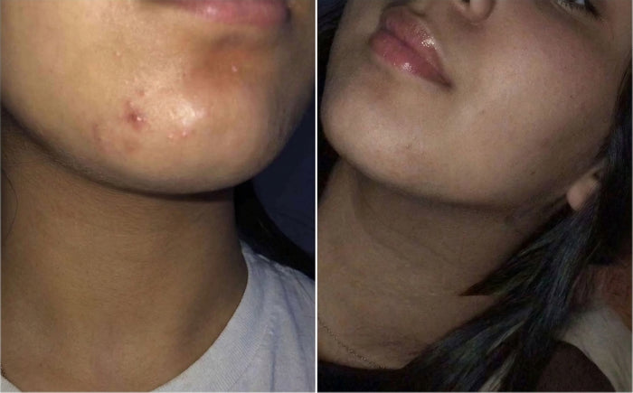 Soins Sweet Nabbody, avant et après, photo d'une cliente