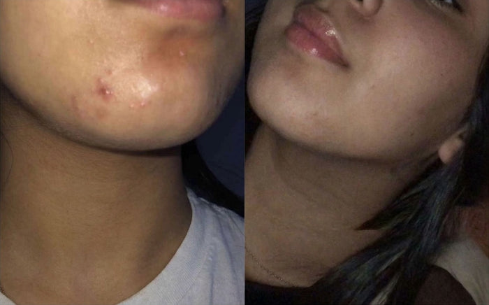 Soins Sweet Nabbody, avant et après, photo d'une cliente