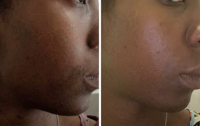 Soins Sweet Nabbody, avant et après, photo d'une cliente