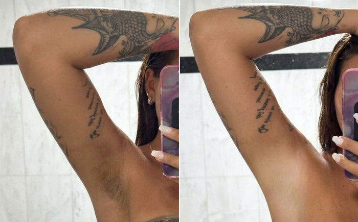Soins Sweet Nabbody, avant et après, photo d'une cliente