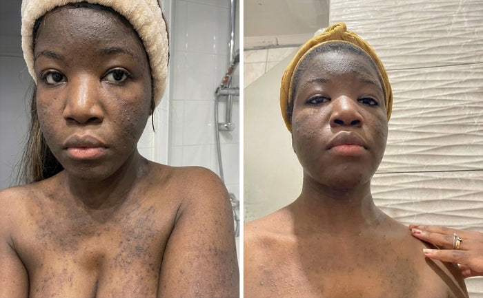 Soins Sweet Nabbody, avant et après, photo d'une cliente