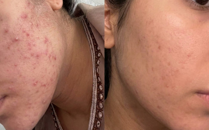 Soins Sweet Nabbody, avant et après, photo d'une cliente