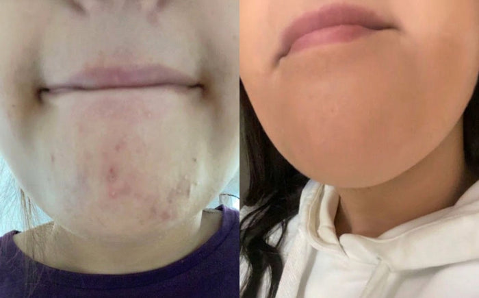 Soins Sweet Nabbody, avant et après, photo d'une cliente