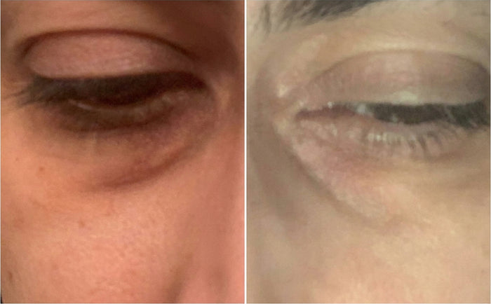 Masque Nila Royal et Crème Anti-Cernes, avant et après, photo d'une cliente