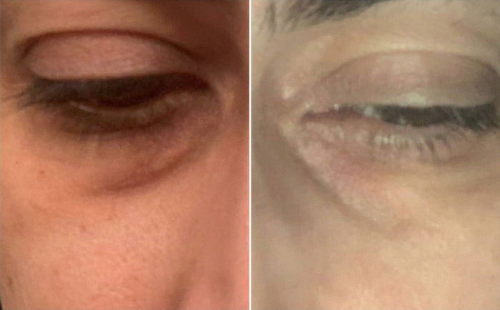 Masque Nila Royal et Crème Anti-Cernes, avant et après, photo d'une cliente
