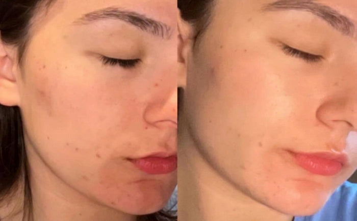 Masque Nila Royal, avant et après, photo d'une cliente