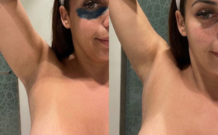 Masque Nila Royal, avant et après, photo d'une cliente