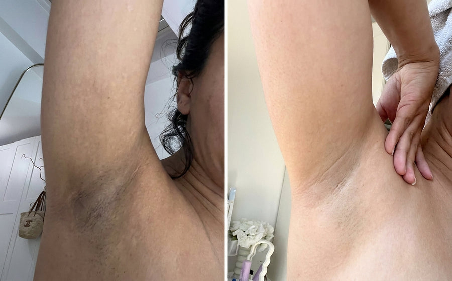 Avant et après, photo d'une cliente, Masque Nila Royal