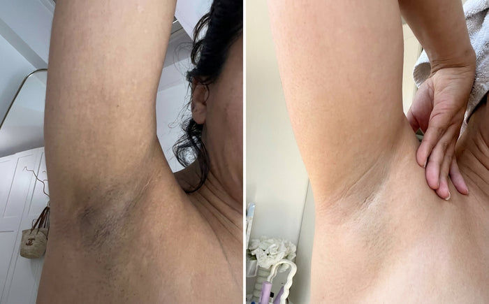 Masque Nila Royal, avant et après, photo d'une cliente