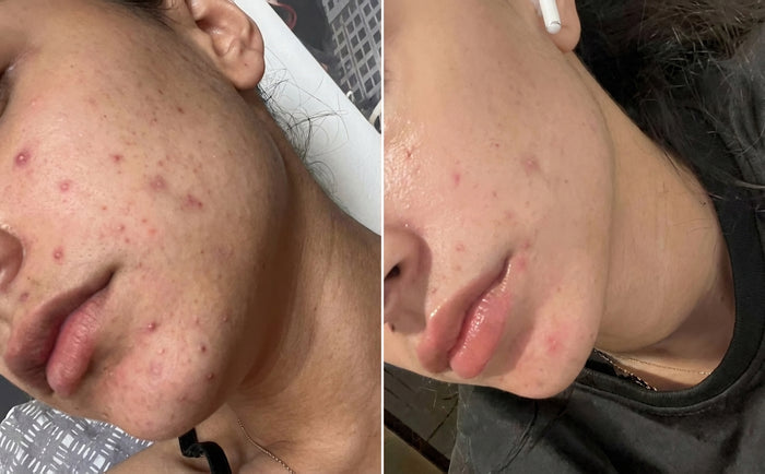 Masque Nila Royal, avant et après, photo d'une cliente