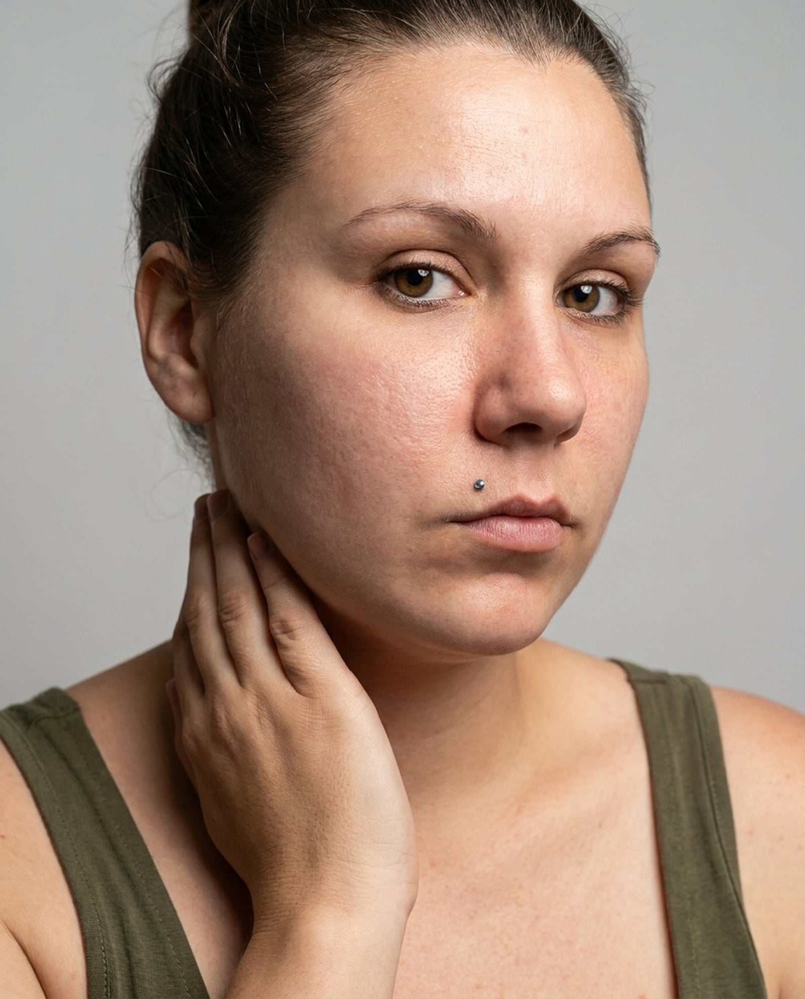 La joue d'une cliente, après, photo envoyée par une cliente, Sweet Nabbody